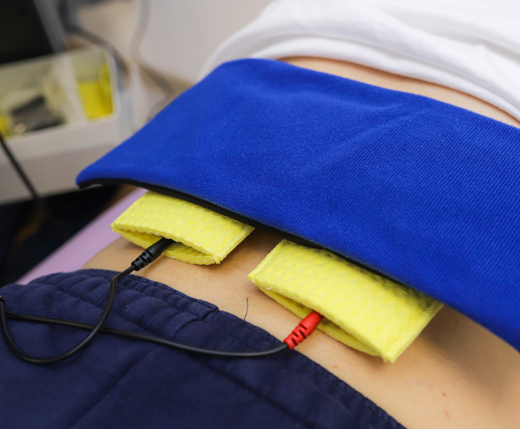 Elektroterapija1-2048x1689